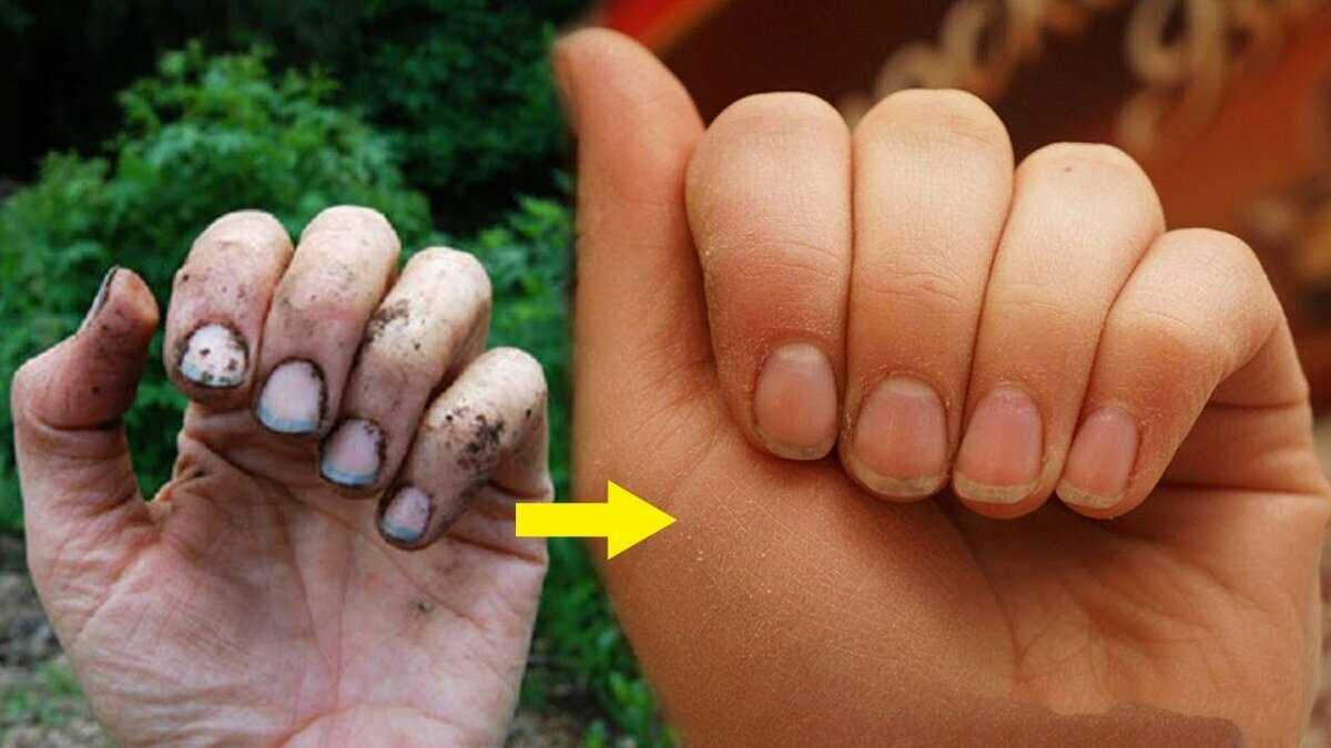 Как очистить руки и ногти от въевшейся грязи после огорода