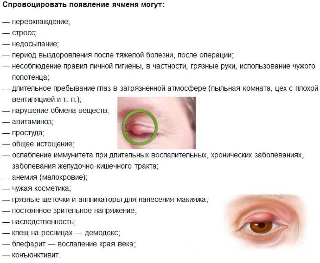 У вас ячмень и вы хотите быстро его вылечить? мы знаем как!