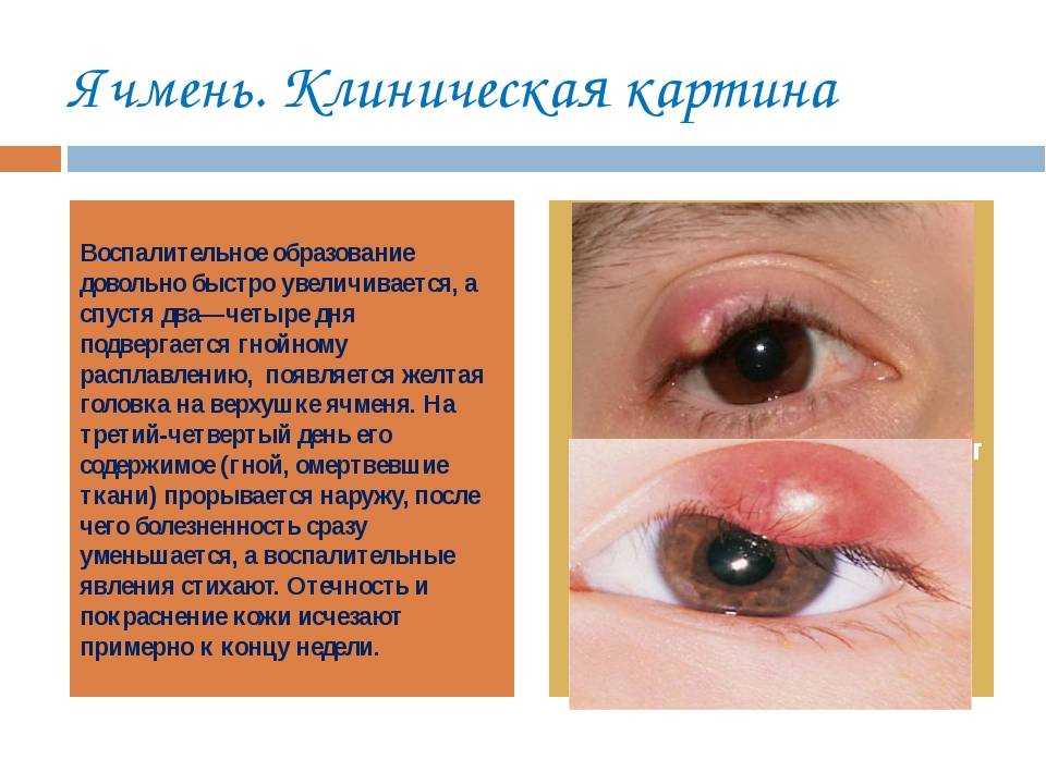 Способы ускорить созревание тыквы